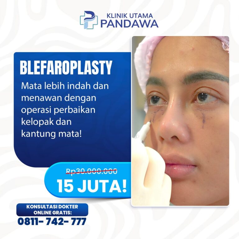 Blefaroplasty.jpg