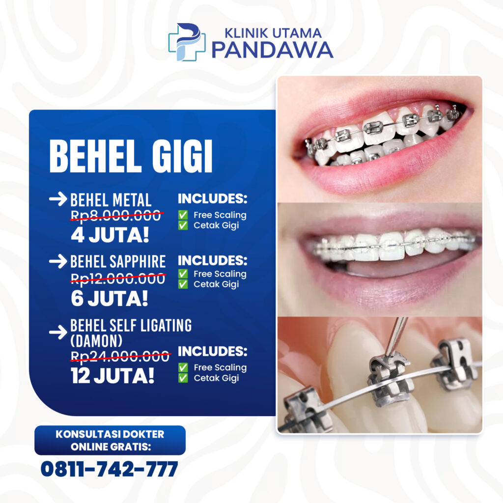 Spesialis Gigi dan Mulut – Klinik Utama Pandawa – Behel